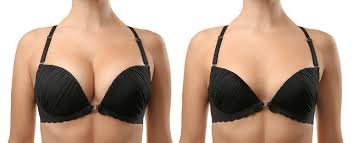 BREAST REDUCTION